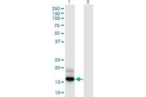 Western Blot analysis of PFDN4 expression in transfected 293T cell line by PFDN4 monoclonal antibody (M03), clone 2G4. (PFDN4 抗体  (AA 1-134))