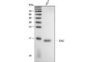Western blot analysis of Angiogenin/ANG using anti-Angiogenin/ANG antibody (ABIN4886457). (ANG 抗体  (AA 25-147))