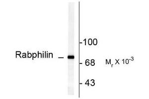 Image no. 1 for anti-Rabphilin 3A (RPH3A) (pSer234) antibody (ABIN372710) (RPH3A 抗体  (pSer234))