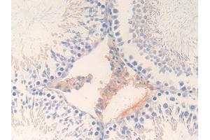 Immunohistochemistry (IHC) image for anti-Glutamate Decarboxylase 2 (Pancreatic Islets and Brain, 65kDa) (GAD2) (AA 188-374) antibody (ABIN7437707)