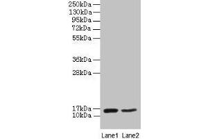 Western blot All lanes: CD59 antibody at 2 μg/mL Lane 1: Mouse heart tissue Lane 2: NIH/3T3 whole cell lysate Secondary Goat polyclonal to rabbit IgG at 1/10000 dilution Predicted band size: 15 kDa Observed band size: 15 kDa (CD59 抗体  (AA 26-102))