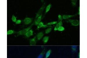 Immunofluorescence analysis of NIH-3T3 cells using FDFT1 Polyclonal Antibody at dilution of 1:100. (FDFT1 抗体)