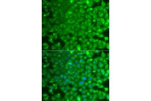 Immunofluorescence analysis of A549 cells using KBTBD7 antibody (ABIN5975133). (KBTBD7 抗体)