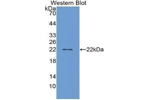 Western blot analysis of recombinant Human PGD2S. (PTGDS 抗体  (AA 32-190))