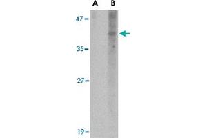 Western blot analysis of NANOS1 in SK-N-SH cell lysate with NANOS1 polyclonal antibody  at 1 ug/mL in (A) the presence and (B) the absence of blocking peptide. (Nanos Homolog 1 抗体  (N-Term))
