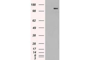 HEK293T cells were transfected with the pCMV6-ENTRY control (Left lane) or pCMV6-ENTRY L1CAM (Right lane) cDNA for 48 hrs and lysed. (L1CAM 抗体)