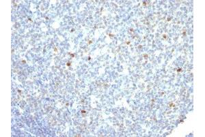 Image no. 2 for Mouse anti-Human IgM antibody (ABIN6155086) (小鼠 anti-人 IgM Antibody)