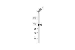 Anti-ROR1 Antibody at 1:4000 dilution + NC-1 whole cell lysate Lysates/proteins at 20 μg per lane. (ROR1 抗体)