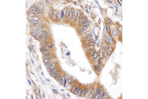 Immunohistochemistry (IHC) image for anti-BH3 Interacting Domain Death Agonist (BID) (AA 60-120) antibody (ABIN7448435)