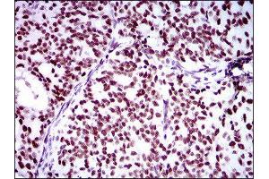 Immunohistochemistry (IHC) image for anti-Ring Finger Protein 1 (RING1) (AA 79-263) antibody (ABIN1845880) (RING1 抗体  (AA 79-263))