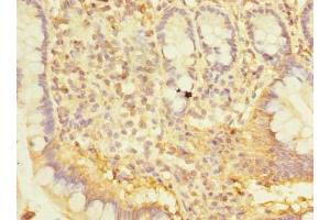 Immunohistochemistry of paraffin-embedded human small intestine tissue using ABIN7170402 at dilution of 1:100 (SNX6 抗体  (AA 1-290))