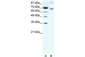 WB Suggested Anti-RACGAP1 Antibody Titration:  1. (RACGAP1 抗体  (N-Term))