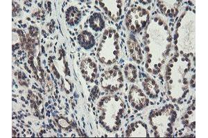 Immunohistochemical staining of paraffin-embedded Human breast tissue using anti-ACBD3 mouse monoclonal antibody. (ACBD3 抗体)