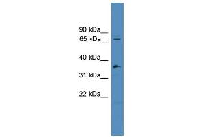 WB Suggested Anti-SF4 Antibody Titration:  0. (Splicing Factor 4 抗体  (C-Term))