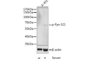 Western blot analysis of extracts of A-431 cells, using Phospho-Fyn-S21 antibody (ABIN6135226, ABIN6136086, ABIN6136087 and ABIN6225545) at 1:1000 dilution. (FYN 抗体  (pSer21))
