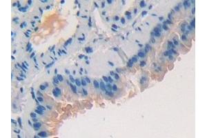 Immunohistochemistry (IHC) image for anti-Mucin 1 (MUC1) (AA 410-525) antibody (ABIN7440383)
