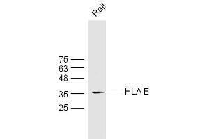 Raji cell lysates probed with Rabbit Anti-HLA E Polyclonal Antibody  at 1:300 overnight at 4˚C. (HLA-E 抗体  (AA 251-358))