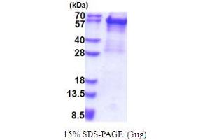 SDS-PAGE (SDS) image for Keratin 5 (KRT5) (AA 1-590) protein (His tag) (ABIN5853651)