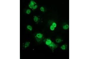 Immunofluorescence (IF) image for anti-Tumor Protein P53 (TP53) antibody (ABIN1499972) (p53 抗体)