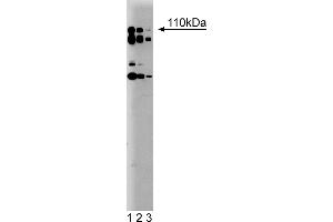 Western Blotting (WB) image for anti-Phosphoinositide-3-Kinase, Catalytic, delta Polypeptide (PIK3CD) (AA 73-90) antibody (ABIN968316) (PIK3CD 抗体  (AA 73-90))