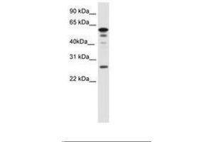 Image no. 1 for anti-Forkhead Box D1 (FOXD1) (AA 24-73) antibody (ABIN6736081) (FOXD1 抗体  (AA 24-73))
