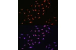 Immunofluorescence analysis of U-2 OS cells using DHX9/DHX9/RNA Helicase A Rabbit mAb (ABIN7265747) at dilution of 1:100 (40x lens). (DHX9 抗体)