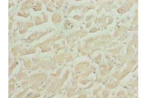 Immunohistochemistry of paraffin-embedded human heart tissue using ABIN7155010 at dilution of 1:100 (HS3ST1 抗体  (AA 21-307))