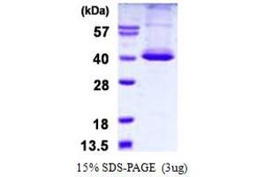 serine/threonine Kinase 16 (STK16) (AA 1-305) protein (His tag)