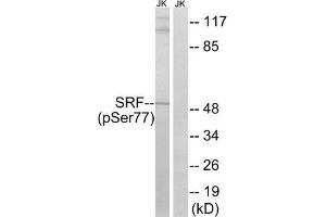 Western blot analysis of extracts from Jurkat cells, treated with PMA (125 ng/mL, 30 mins), using SRF (Phospho-Ser77) antibody. (SRF 抗体  (pSer77))
