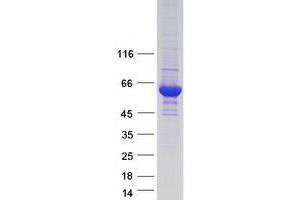 Western Blotting (WB) image for Asparagine Synthetase (ASNS) (Transcript Variant 3) protein (Myc-DYKDDDDK Tag) (ABIN2714991)