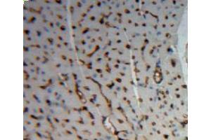 IHC-P analysis of heart tissue, with DAB staining. (ACTN2 抗体  (AA 1-254))