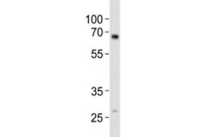 Western blot analysis of lysate from mouse kidney tissue using ALK3 antibody diluted at 1:1000. (BMPR1A 抗体  (AA 30-60))