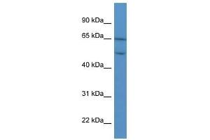 COL8A2 antibody used at 0. (COL8a2 抗体  (C-Term))