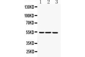 Western blot analysis of FGG expression in rat liver extract ( Lane 1), mouse liver extract ( Lane 2) and HEPG2 whole cell lysates ( Lane 3). (FGG 抗体  (N-Term))