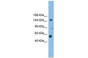 Image no. 1 for anti-DEAH (Asp-Glu-Ala-His) Box Polypeptide 8 (DHX8) (AA 71-120) antibody (ABIN6744511) (DHX8 抗体  (AA 71-120))