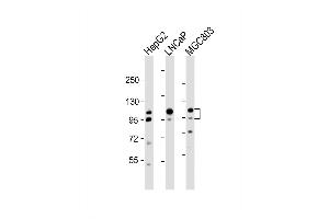 Western Blot at 1:2000 dilution Lane 1: HepG2 whole cell lysate Lane 2: LNCaP whole cell lysate Lane 3: MGC803 whole cell lysate Lysates/proteins at 20 ug per lane.