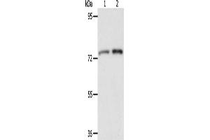 Gel: 8 % SDS-PAGE, Lysate: 40 μg, Lane 1-2: Mouse liver tissue, Mouse kidney tissue, Primary antibody: ABIN7128172(ACOX2 Antibody) at dilution 1/350, Secondary antibody: Goat anti rabbit IgG at 1/8000 dilution, Exposure time: 2 minutes (Acox2 抗体)