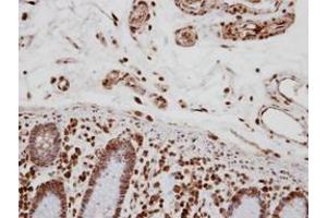 Image no. 1 for anti-Transcription Elongation Regulator 1 (TCERG1) (AA 419-1077) antibody (ABIN1501339) (TCERG1 抗体  (AA 419-1077))