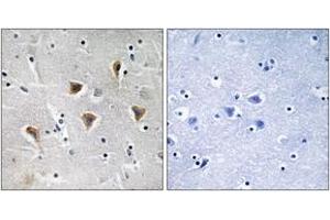 Immunohistochemistry analysis of paraffin-embedded human brain tissue, using MTERF Antibody. (MTERF 抗体  (AA 267-316))