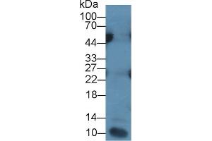 Detection of IL7 in Human Leukocyte lysate using Monoclonal Antibody to Interleukin 7 (IL7) (IL-7 抗体  (AA 26-177))
