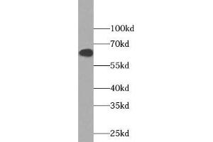 Western blot analysis of Jurkat cells subjected to SDS-PAGE, using NOX5 antibody (1:1000 dilution). (NOX5 抗体)