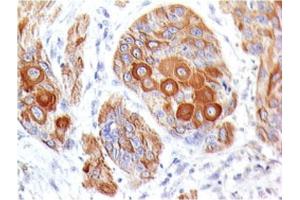 Immunohistochemistry (IHC) image for anti-CD86 (CD86) antibody (ABIN6941141)