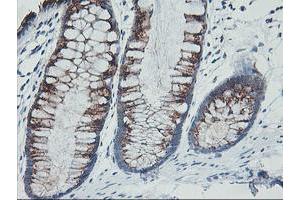 Immunohistochemical staining of paraffin-embedded Human colon tissue using anti-GOLM1 mouse monoclonal antibody. (GOLM1 抗体)