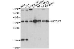 Western blot analysis of extracts of various cell lines, using C1QTNF5 antibody (ABIN1871381) at 1:1000 dilution. (CTRP5 抗体)