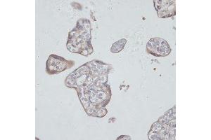 Immunohistochemistry of paraffin-embedded human placenta using TFRC antibody. (Transferrin Receptor 抗体  (AA 1-140))