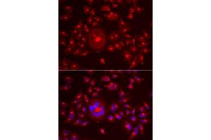 Immunofluorescence analysis of A549 cells using GORASP1 antibody. (GORASP1 抗体  (AA 221-440))