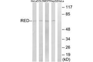 Western Blotting (WB) image for anti-Protein Red (IK) (AA 508-557) antibody (ABIN2890548) (Protein Red (IK) (AA 508-557) 抗体)