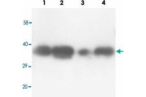 Western blot analysis of tissue lysates with TNFAIP1 polyclonal antibody . (TNFAIP1 抗体  (N-Term))