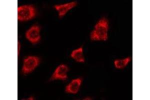 ABIN6278607 staining Hela by IF/ICC. (OR2T5/2T29 抗体)