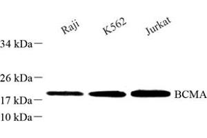 Western blot analysis of BCMA (ABIN7076067) at dilution of 1: 250 (BCMA 抗体)